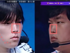 【蜗牛电竞】网友细扒Bin脸部变化细节:鼻梁变直变长;脸颊软组织折叠变化