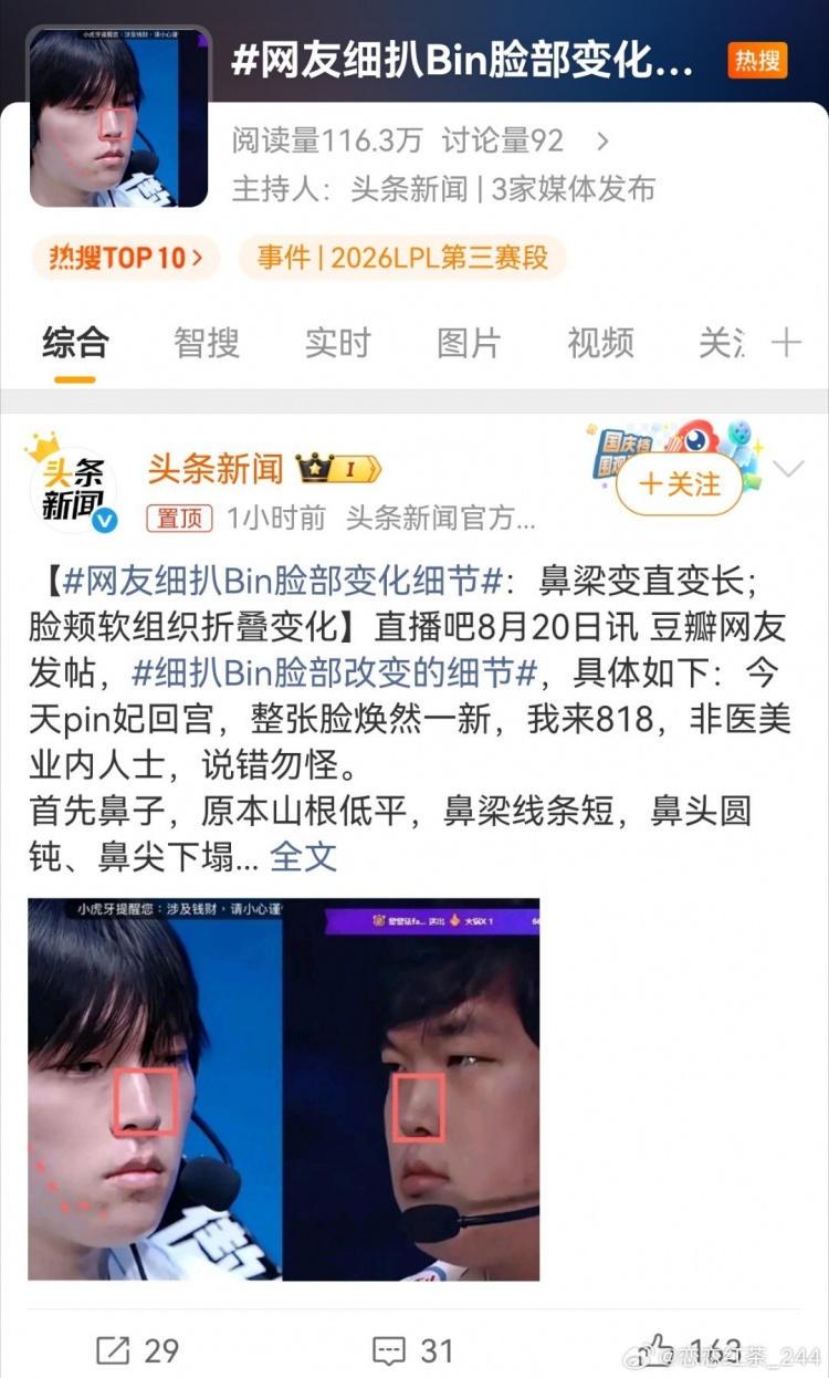 【蜗牛电竞】LPL顶流的待遇：三家官媒蓝V一同下场，齐推话题“Bin脸部细节”